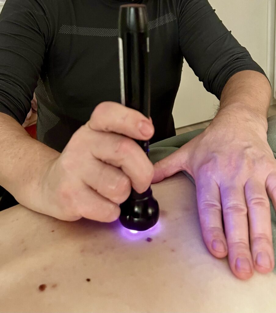 Triggerpunkter kan opsændes med hjælp af powerlaser